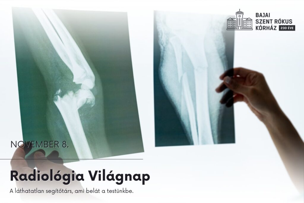 2025. november 8. – Radiológia Világnap